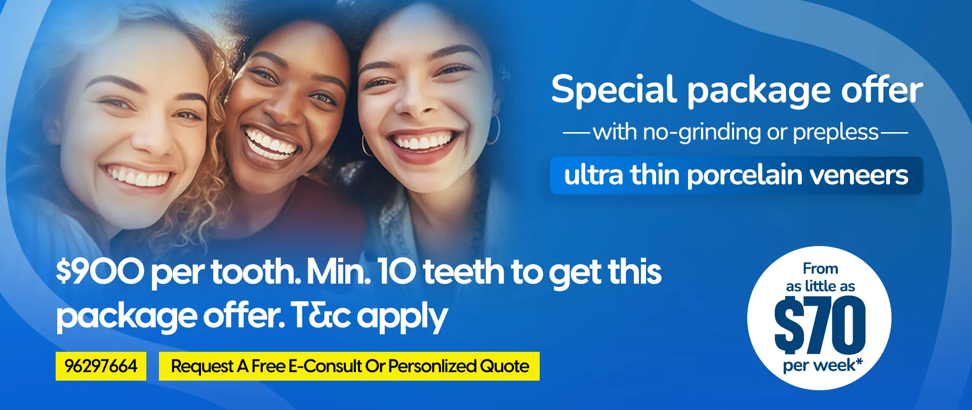 PORCELAIN VENEERS SPECIAL OFFER AND PACKAGES MELBOURNE CBD ABD NOBLE PARK NORTH, WHEELERS HILL, MULGRAVE, GLEN WAVERLEY, SPRINGVALE, DANDENONG