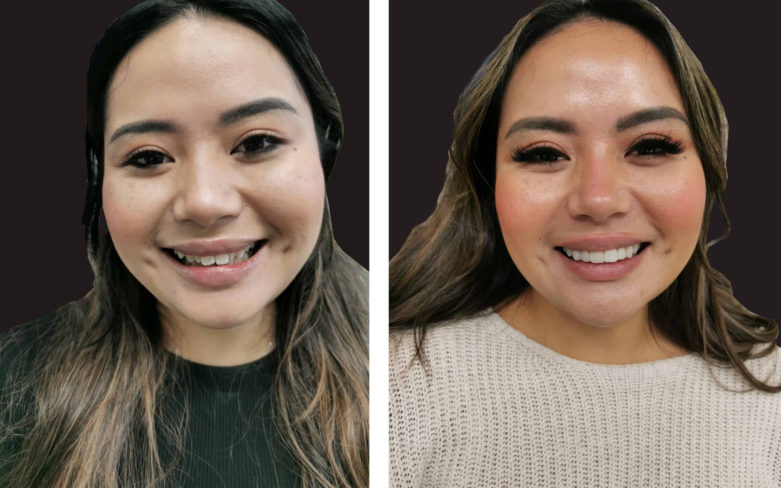 Best, Most affordable Cosmetic Dentist near me in Noble Park North, Springvale, Dandenong
