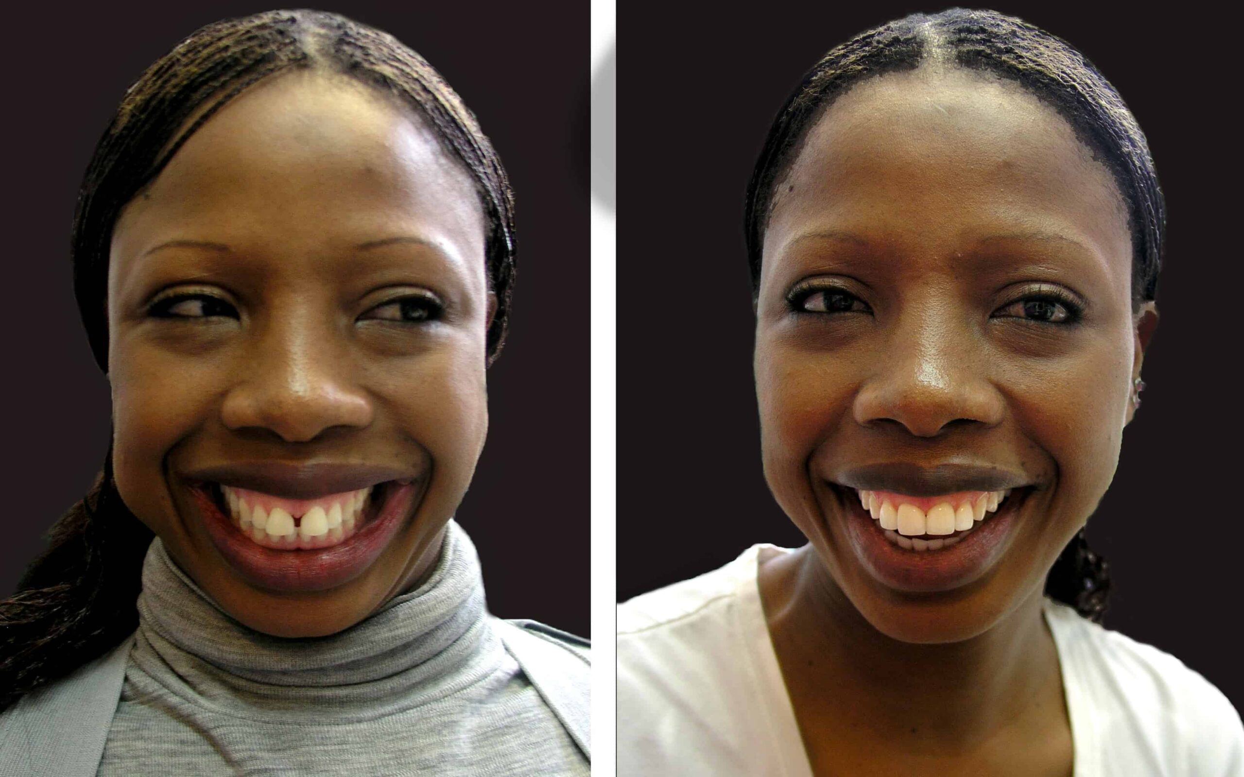 Best, Most affordable Cosmetic Dentist near me in Noble Park North, Springvale, Dandenong