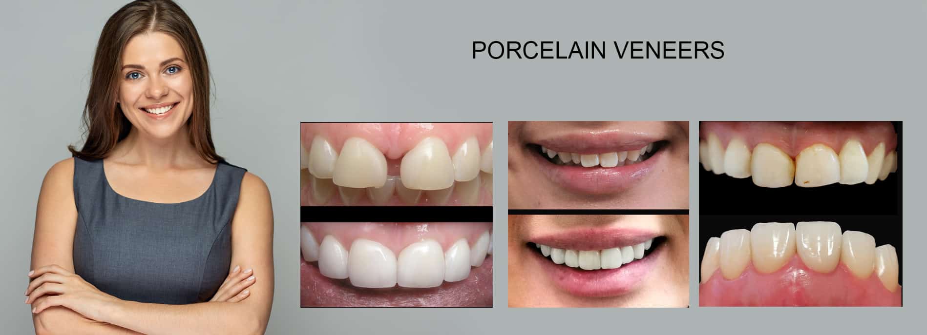 Dentist Noble Park North - DENTIST NEAR ME | VOGUE SMILES MELBOURNE- BEST DENTIST IN NOBLE PARK NORTH REVIEWS