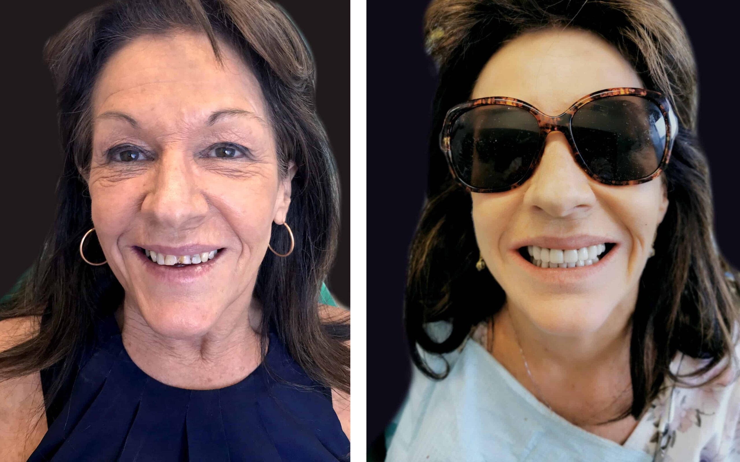 Best, Most affordable Cosmetic Dentist near me in Noble Park North, Springvale, Dandenong
