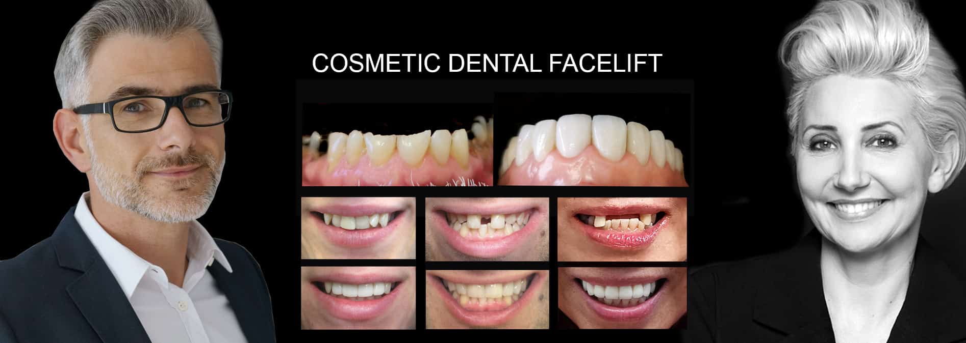 Dentist Noble Park North - DENTIST NEAR ME | VOGUE SMILES MELBOURNE- BEST DENTIST IN NOBLE PARK NORTH REVIEWS