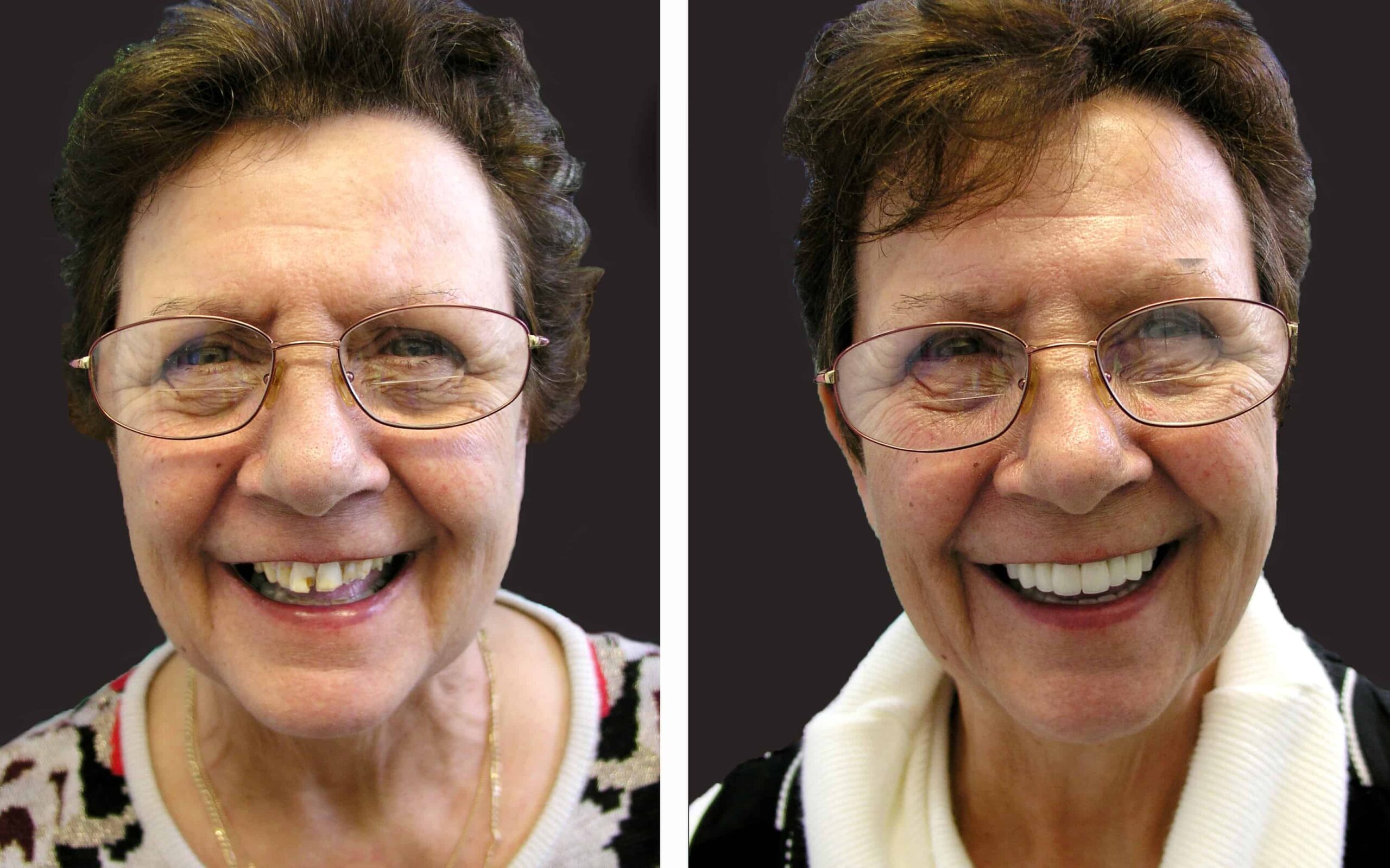 Best, Most affordable Cosmetic Dentist near me in Noble Park North, Springvale, Dandenong