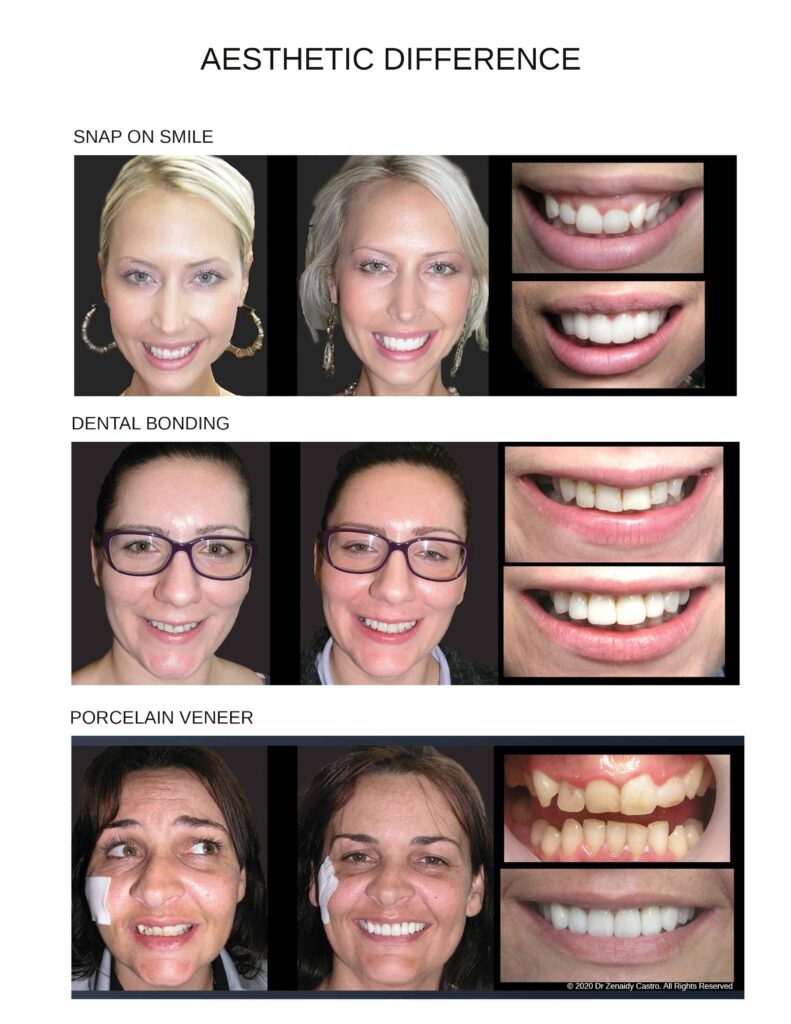 Affordable-Cheap-Cosmetic-Smile-Makeover