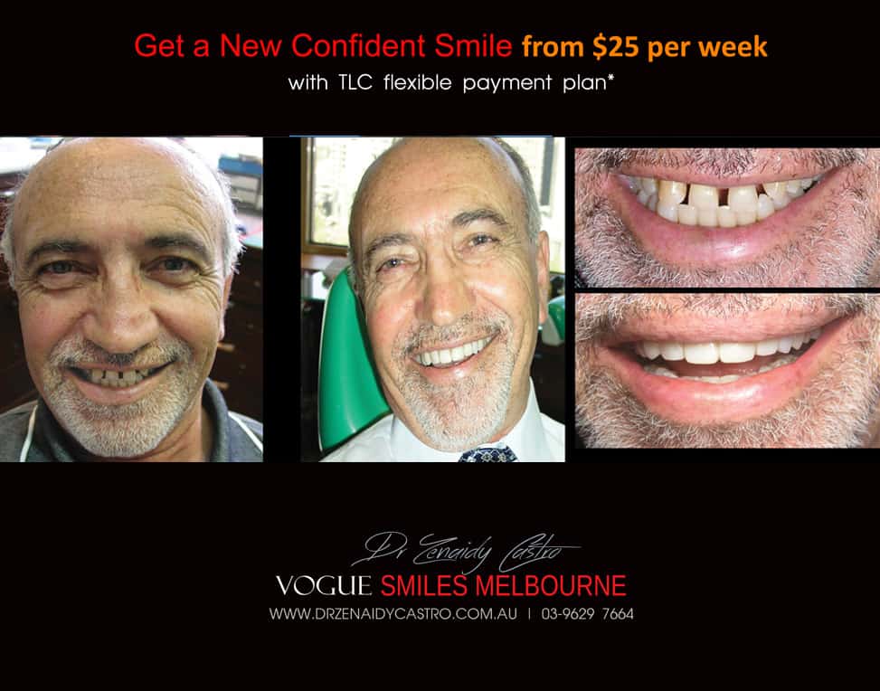 Affordable-Cheap-Cosmetic-Smile-Makeover