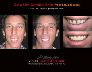 Budget friendly Dental Makeover prices and packages