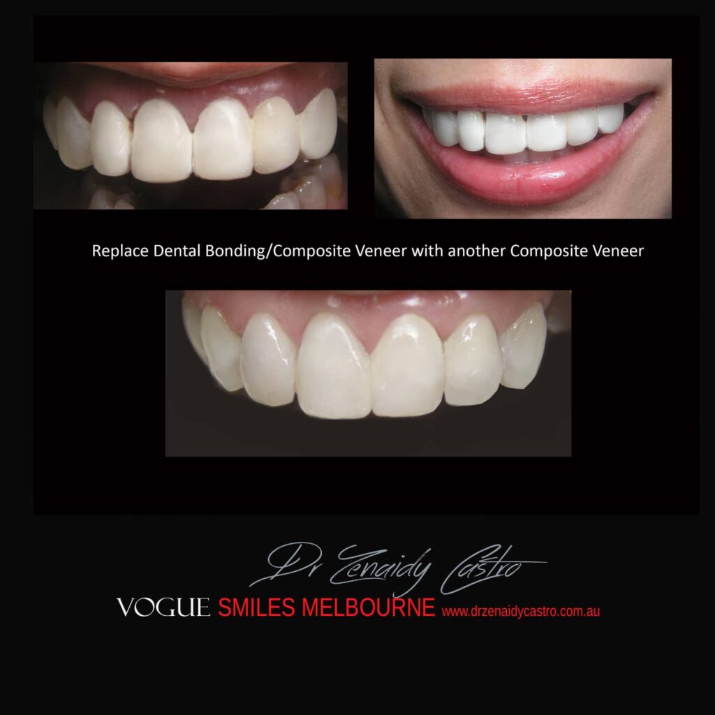 Affordable-Cheap-Cosmetic-Smile-Makeover