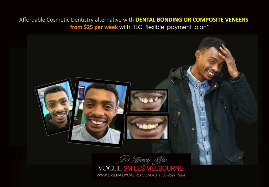 Affordable-Cheap-Cosmetic-Smile-Makeover