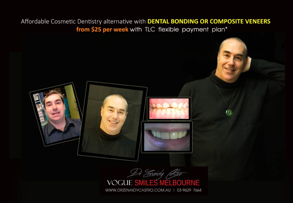 Affordable-Cheap-Cosmetic-Smile-Makeover