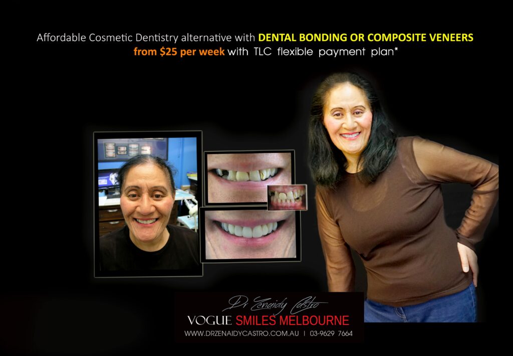 Affordable-Cheap-Cosmetic-Smile-Makeover