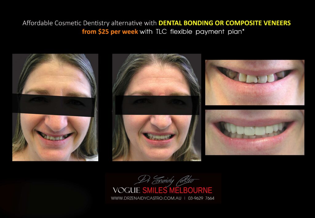 Affordable-Cheap-Cosmetic-Smile-Makeover