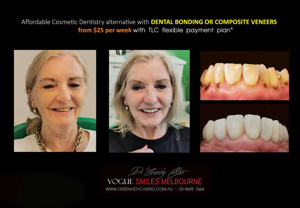Affordable-Cheap-Cosmetic-Smile-Makeover