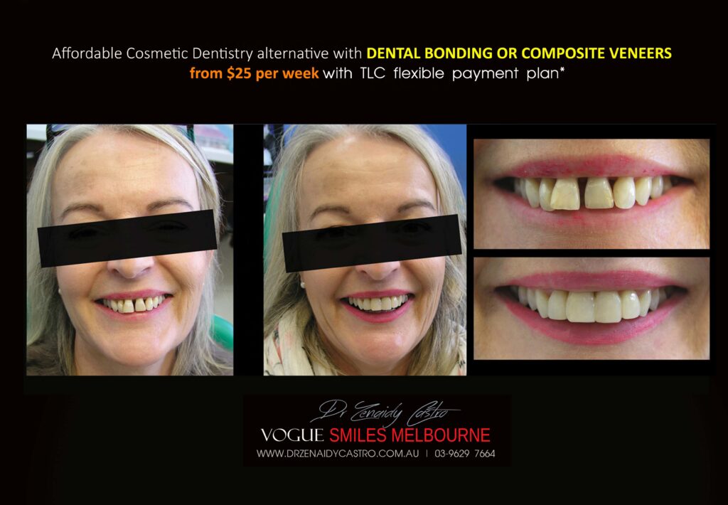 Affordable-Cheap-Cosmetic-Smile-Makeover