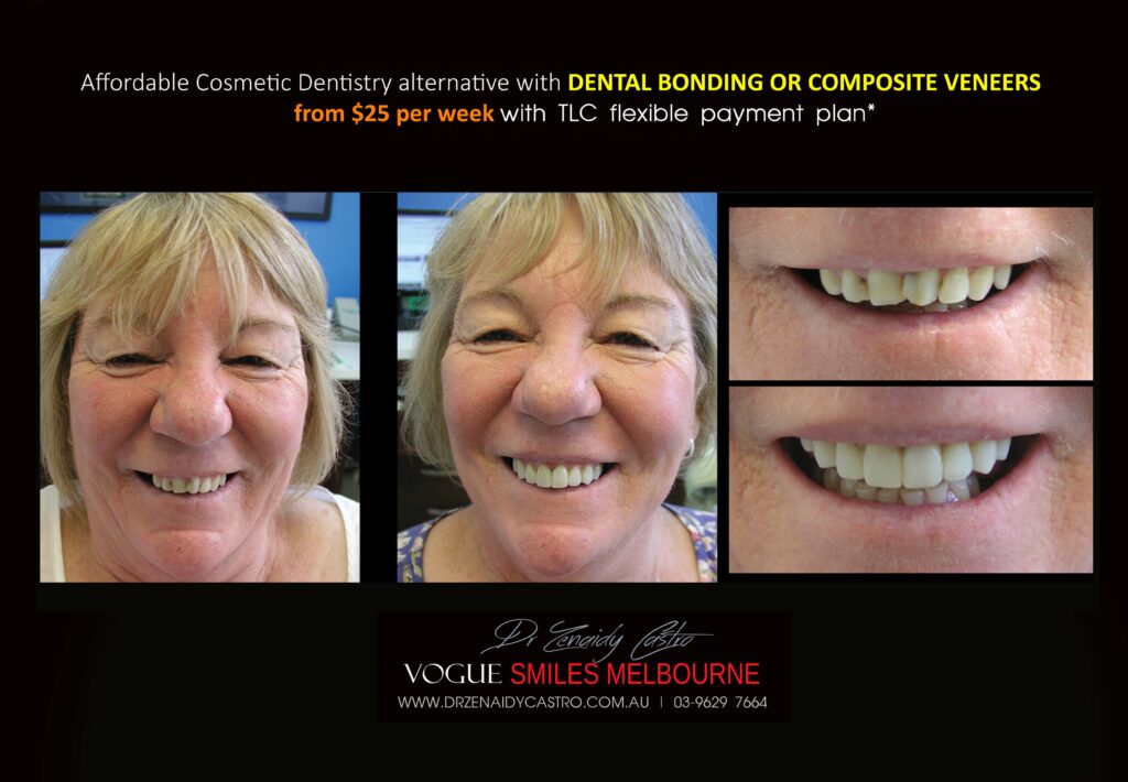Affordable-Cheap-Cosmetic-Smile-Makeover