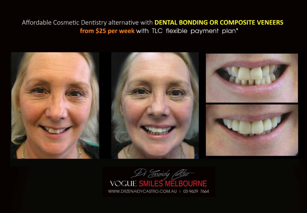 Affordable-Cheap-Cosmetic-Smile-Makeover