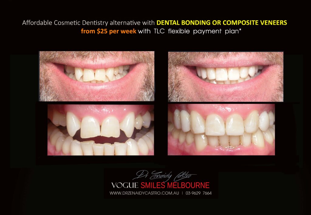 Affordable-Cheap-Cosmetic-Smile-Makeover