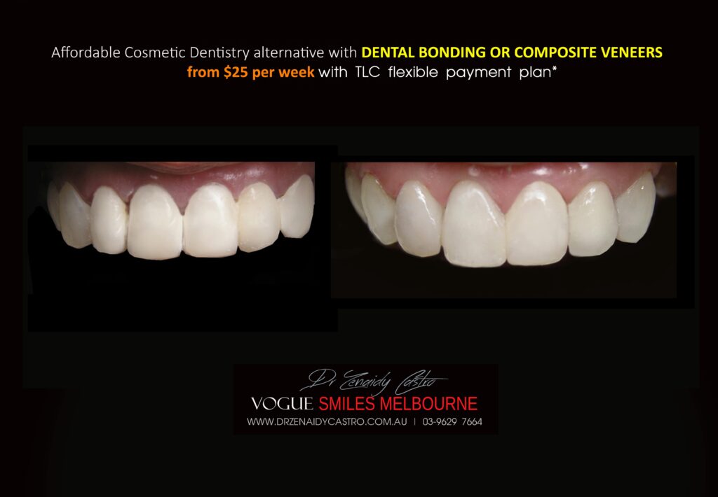 Affordable-Cheap-Cosmetic-Smile-Makeover