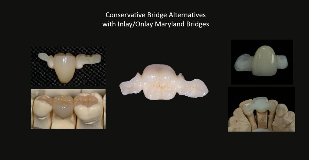 Affordable-Cheap-Cosmetic-Smile-Makeover