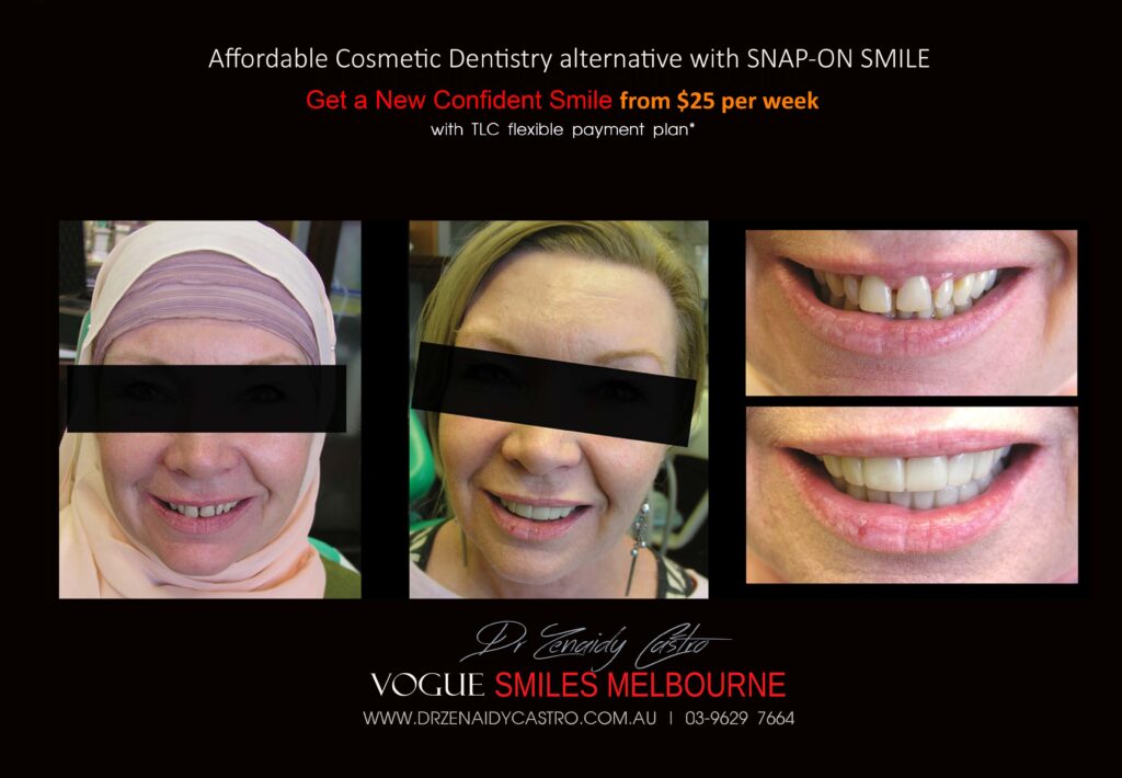 Affordable-Cheap-Cosmetic-Smile-Makeover