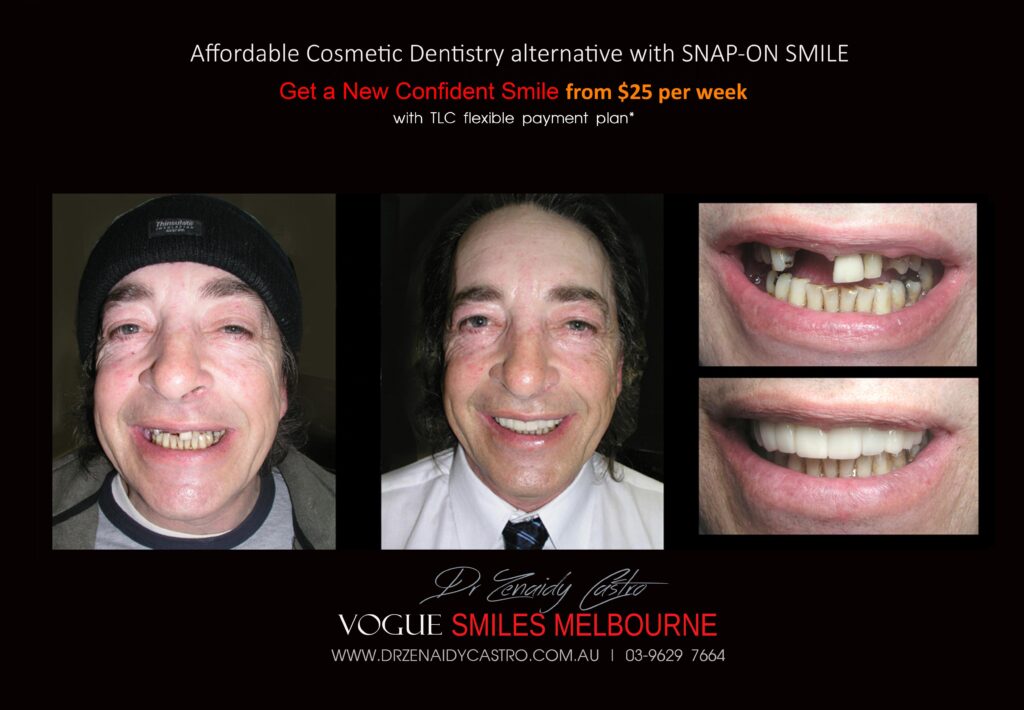 Affordable-Cheap-Cosmetic-Smile-Makeover