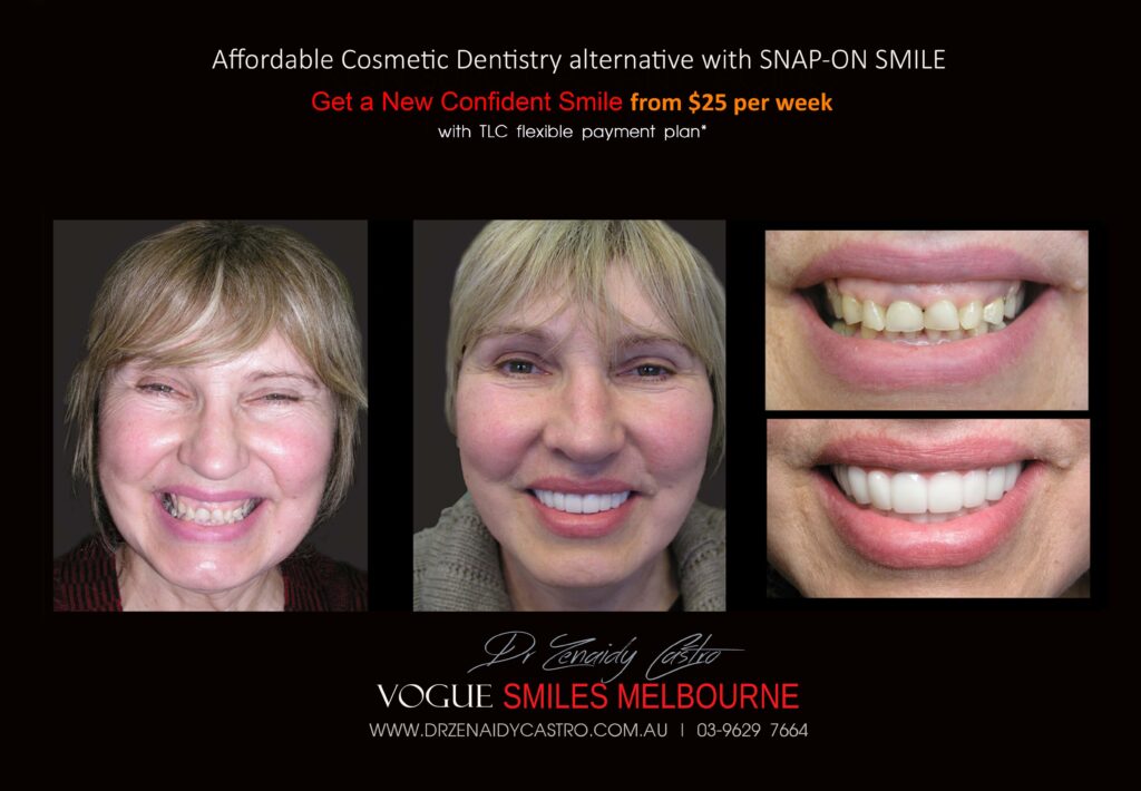 Affordable-Cheap-Cosmetic-Smile-Makeover