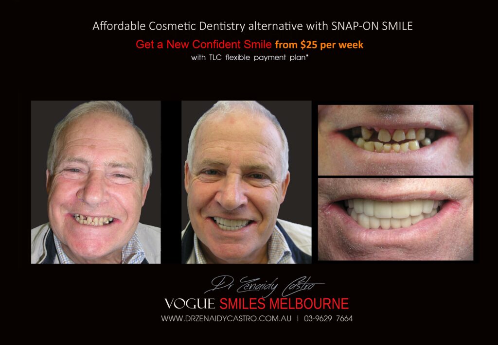 Affordable-Cheap-Cosmetic-Smile-Makeover