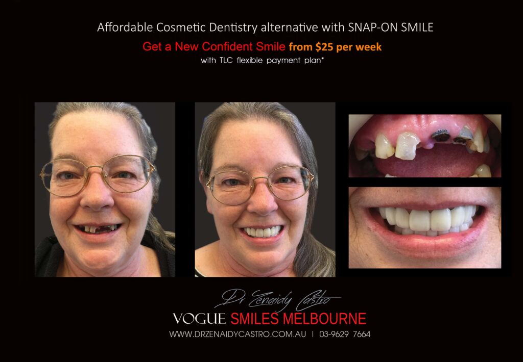 Affordable-Cheap-Cosmetic-Smile-Makeover
