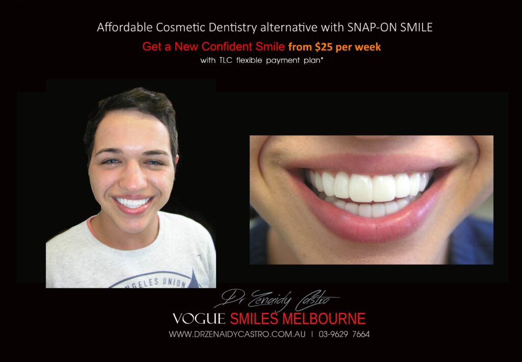Affordable-Cheap-Cosmetic-Smile-Makeover