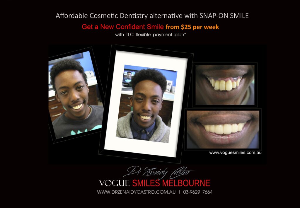 Affordable-Cheap-Cosmetic-Smile-Makeover