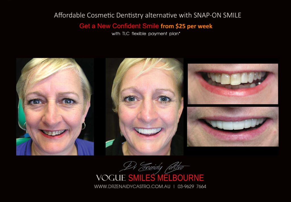 Affordable-Cheap-Cosmetic-Smile-Makeover