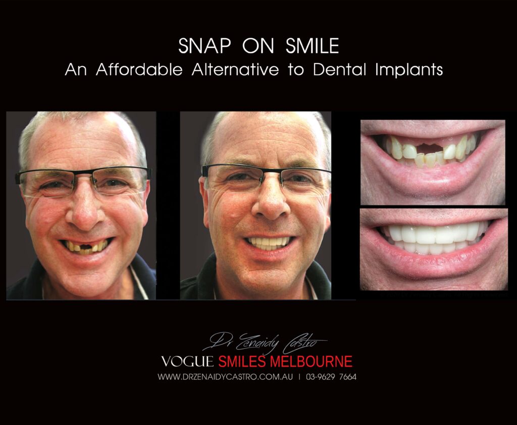 Affordable-Cheap-Cosmetic-Smile-Makeover