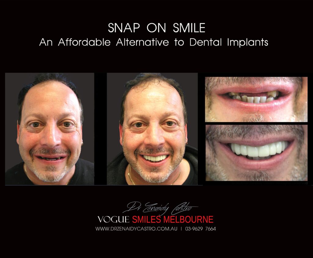 Affordable-Cheap-Cosmetic-Smile-Makeover