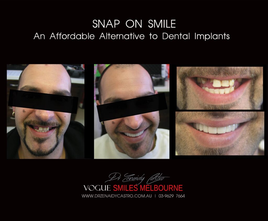 Affordable-Cheap-Cosmetic-Smile-Makeover