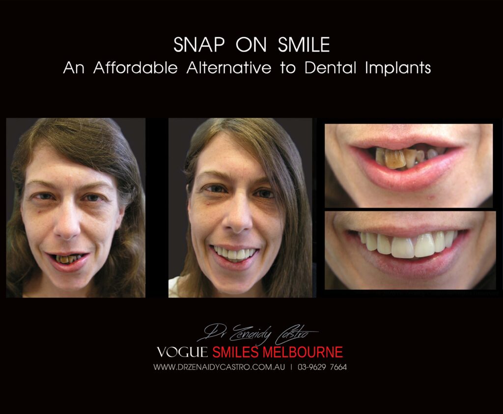Affordable-Cheap-Cosmetic-Smile-Makeover