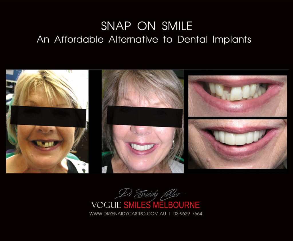 Affordable-Cheap-Cosmetic-Smile-Makeover