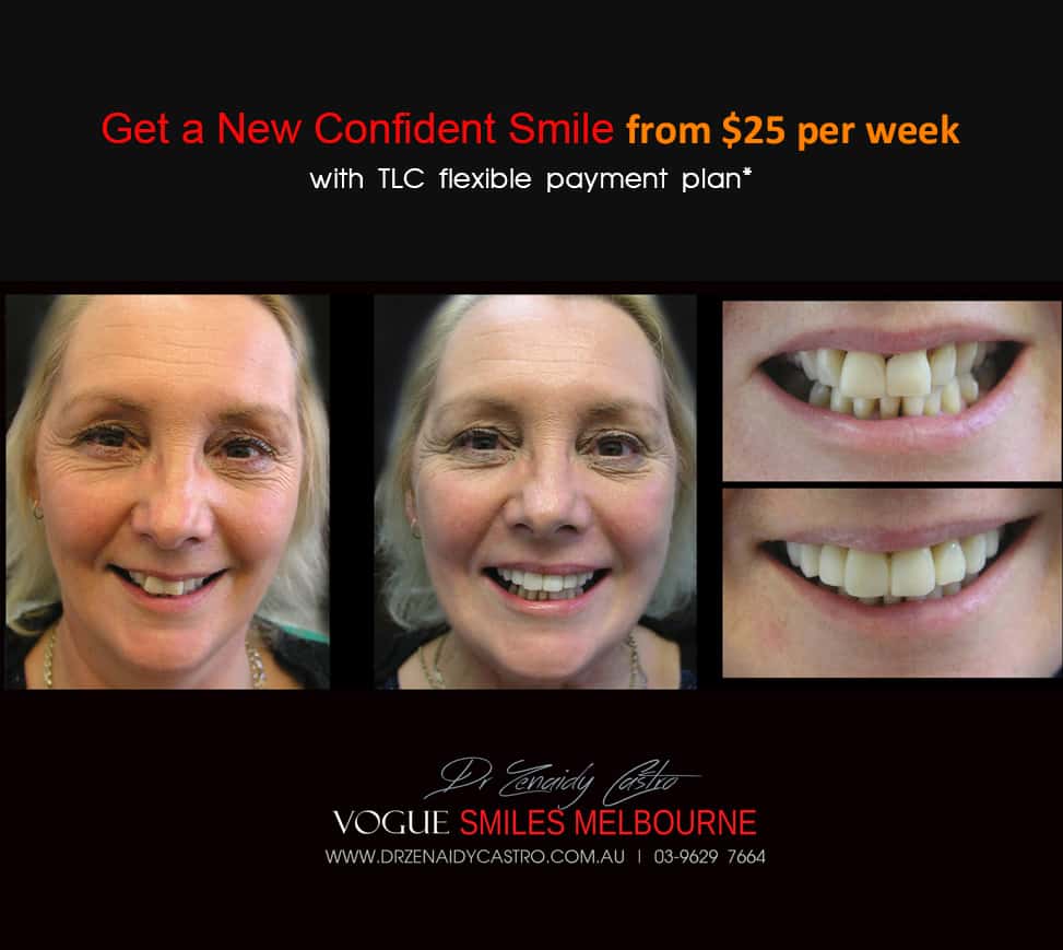 Affordable-Cheap-Cosmetic-Smile-Makeover