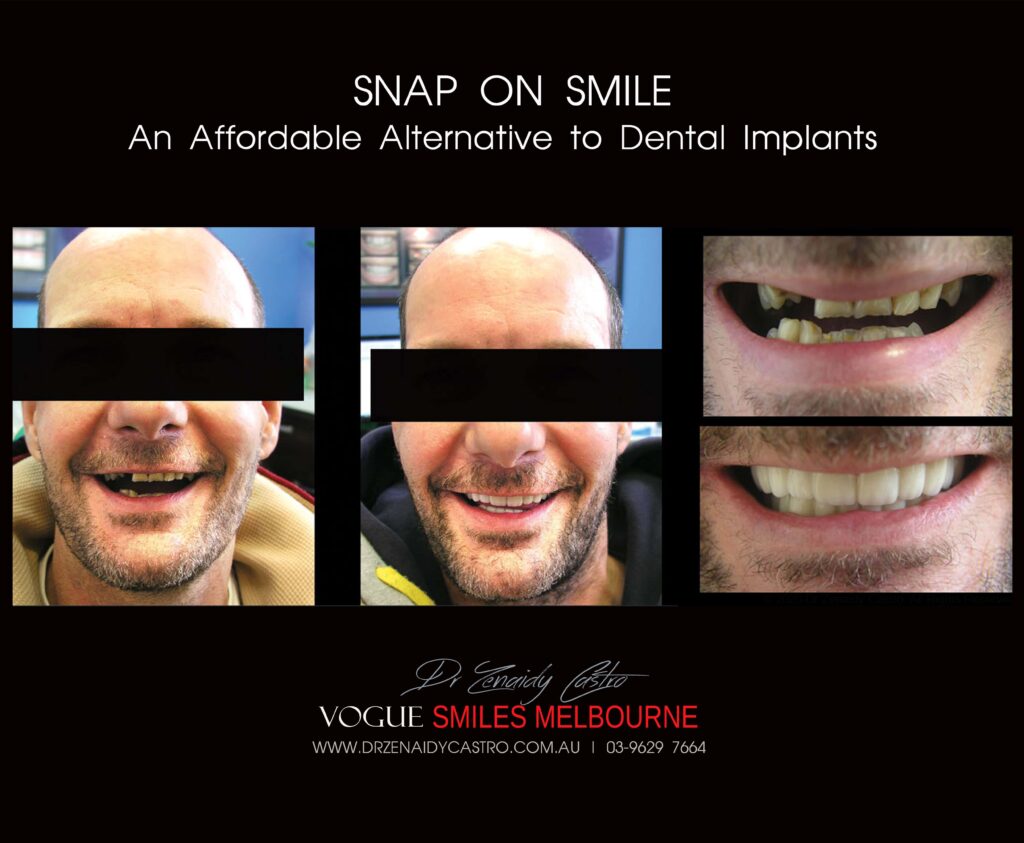Affordable-Cheap-Cosmetic-Smile-Makeover