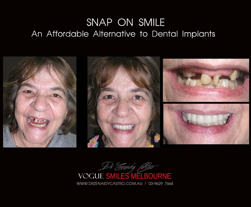 Affordable-Cheap-Cosmetic-Smile-Makeover