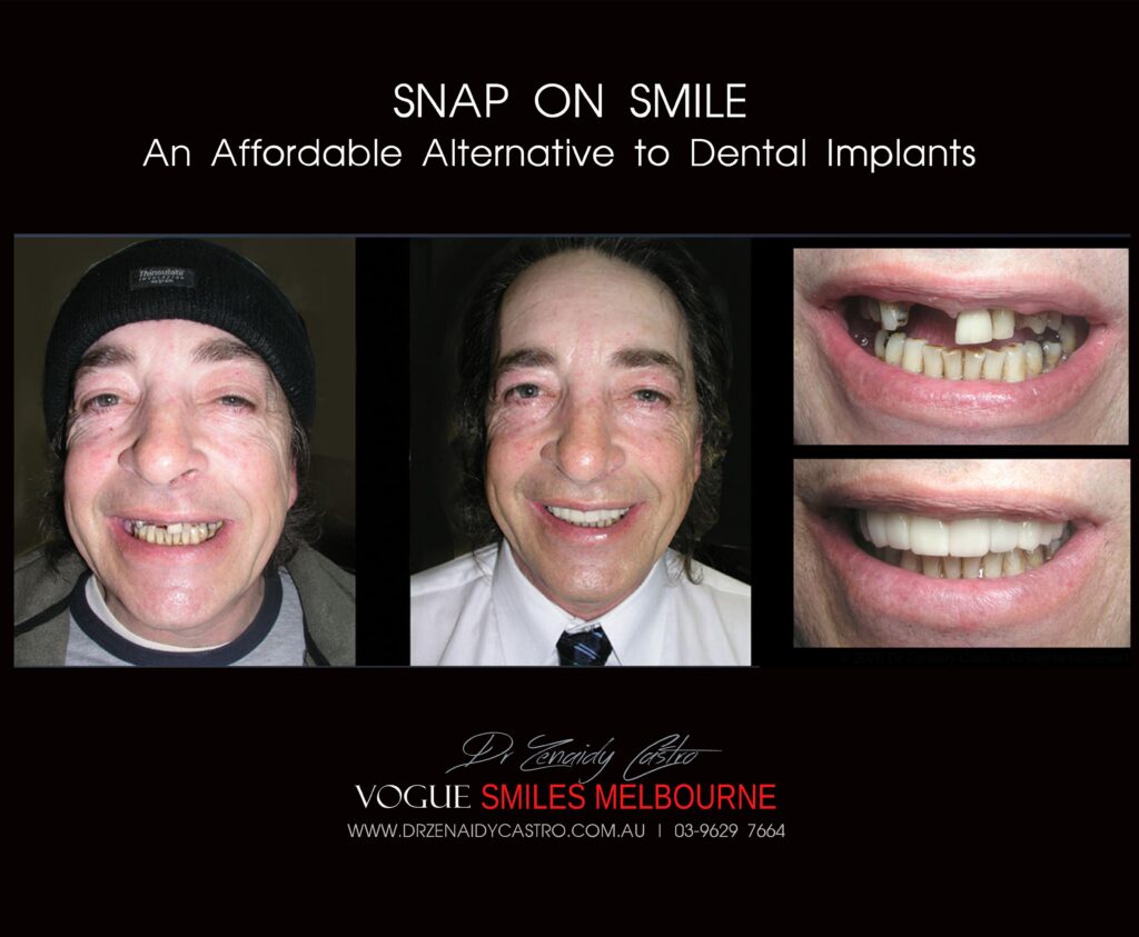 Affordable-Cheap-Cosmetic-Smile-Makeover
