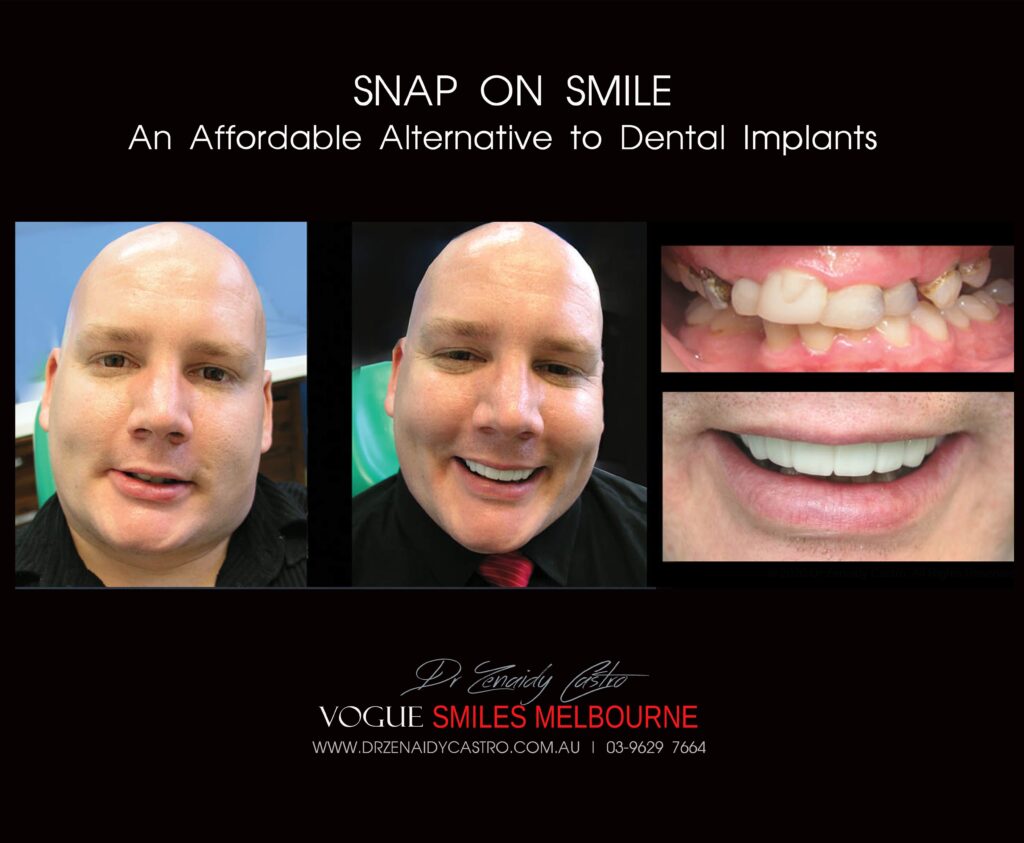Affordable-Cheap-Cosmetic-Smile-Makeover