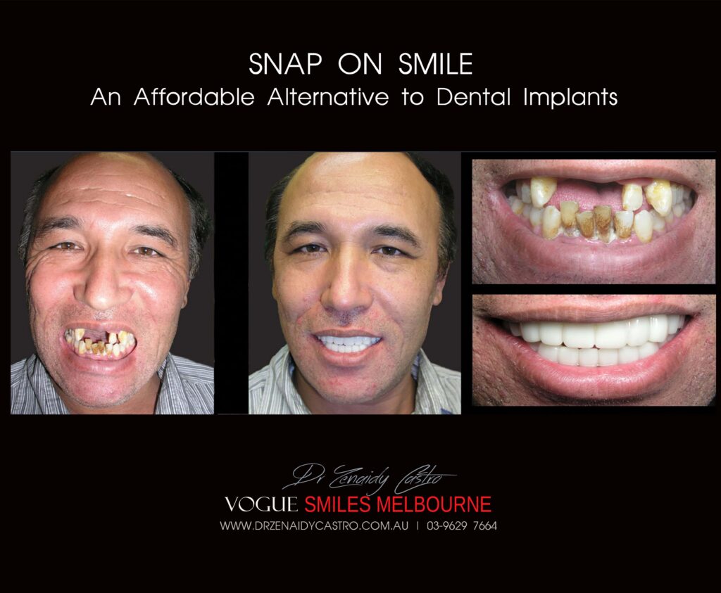Affordable-Cheap-Cosmetic-Smile-Makeover