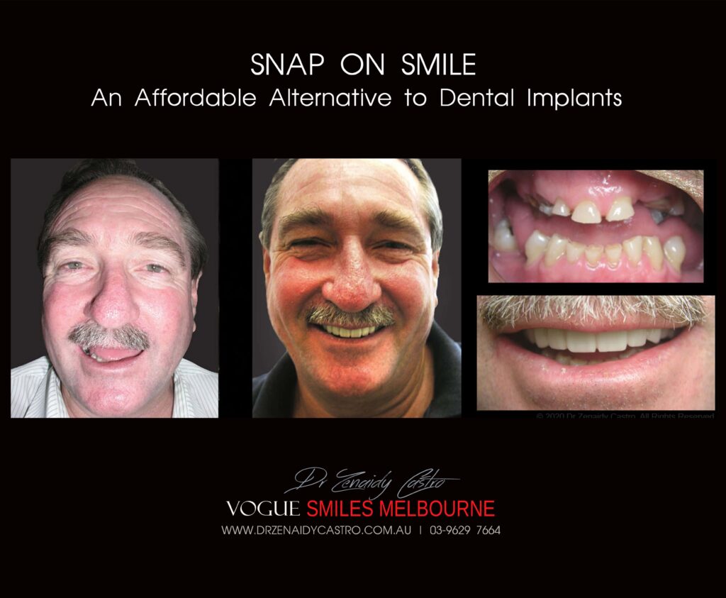 Affordable-Cheap-Cosmetic-Smile-Makeover