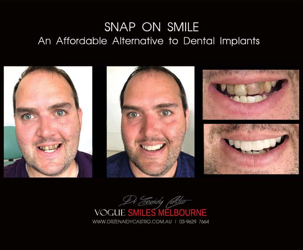 Affordable-Cheap-Cosmetic-Smile-Makeover