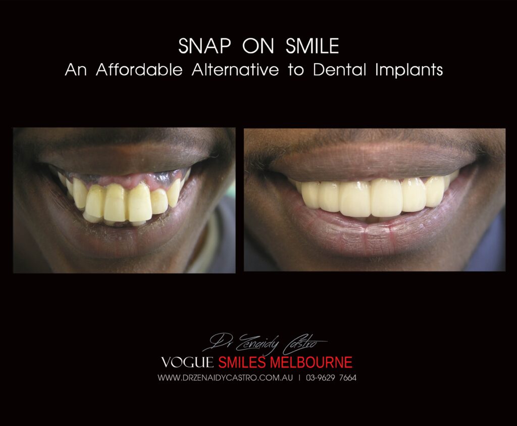 Affordable-Cheap-Cosmetic-Smile-Makeover