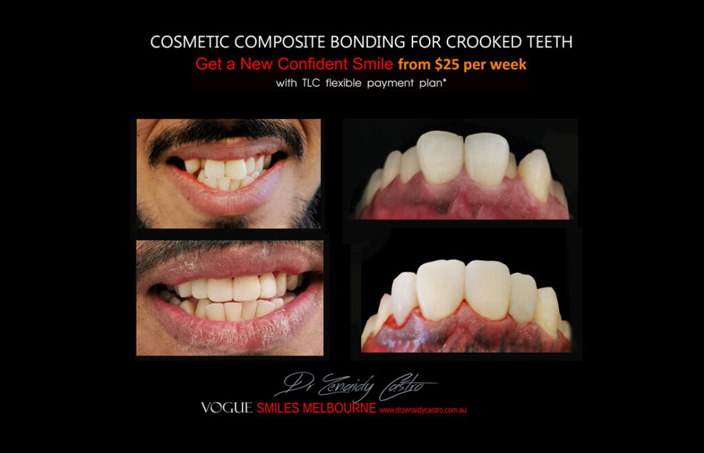 Affordable-Cheap-Cosmetic-Smile-Makeover