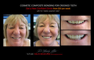 Affordable Cosmetic Dentistry in Melbourne: Where to Go