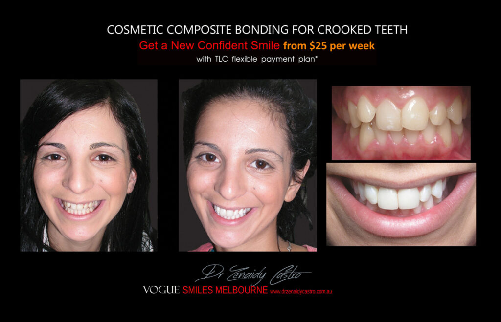 Affordable-Cheap-Cosmetic-Smile-Makeover