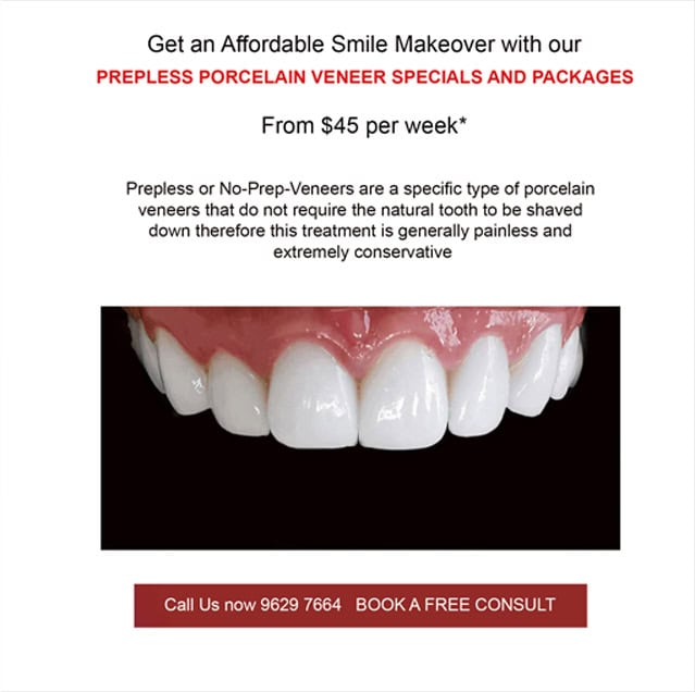 Porcelain Dental Veneers in Noble Park North