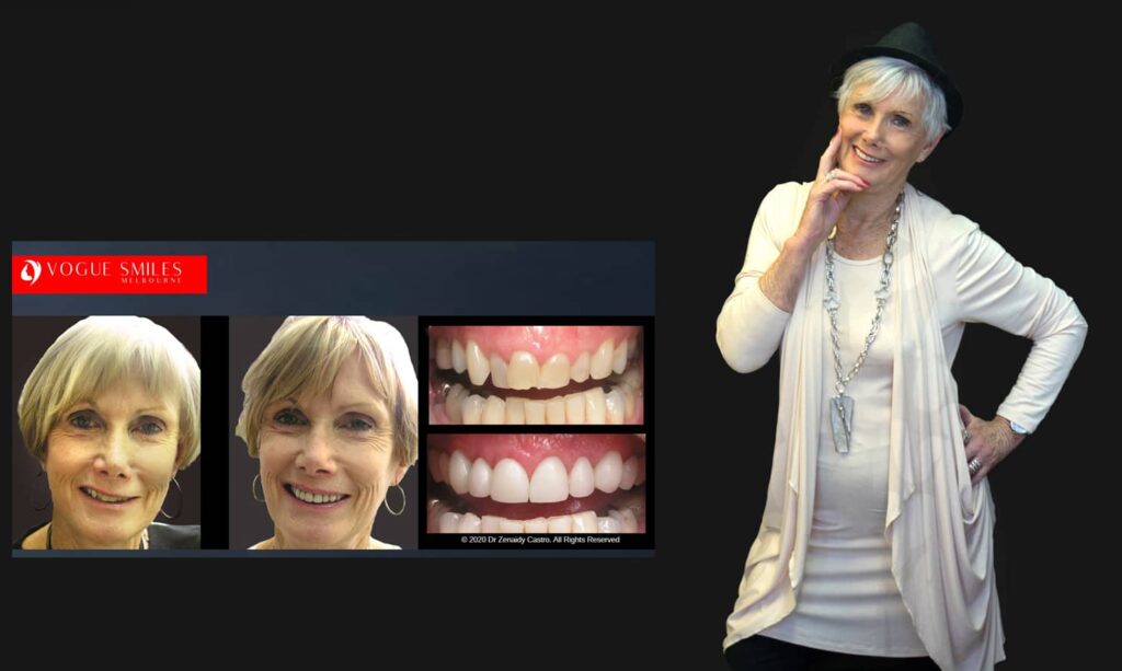 Cosmetic Dentistry near Mulgrave VIC - Cosmetic Dentist in Mulgrave VIC Australia