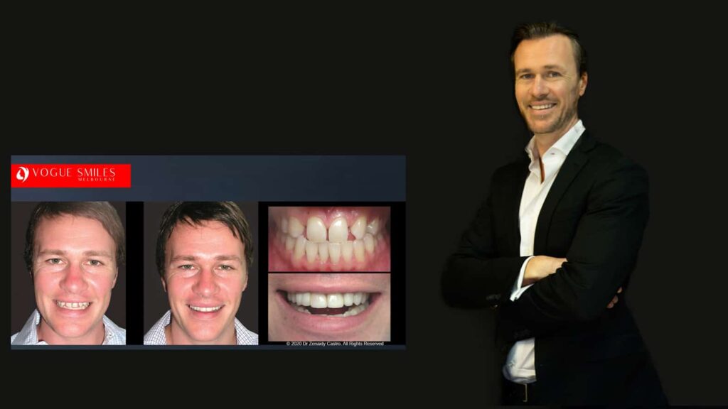 Cosmetic Dentistry near Mulgrave VIC - Cosmetic Dentist in Mulgrave VIC Australia